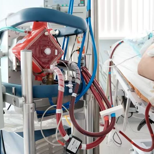 Metodă revoluționară de resuscitare la Iași a celor înghețați de frig sau intoxicați grav. Tot sângele e scos din corp și trecut printr-un aparat care-l încălzește și oxigenează