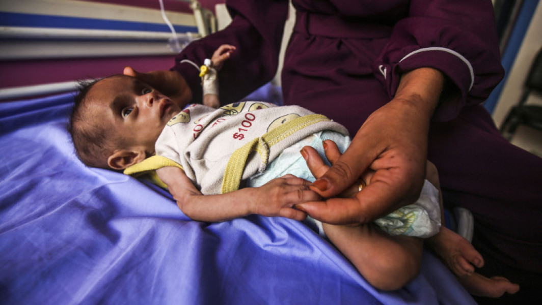 Galerie Foto „Înfometare în masă”. Numărul copiilor subnutriți din Gaza, cu vârste sub 5 ani, s-a triplat în ultimele două săptămâni
